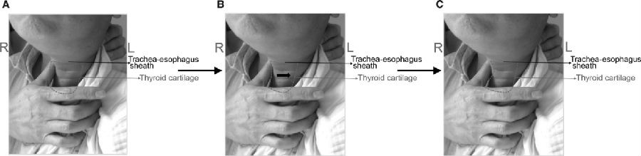 1498034188244935.jpg 3.jpg