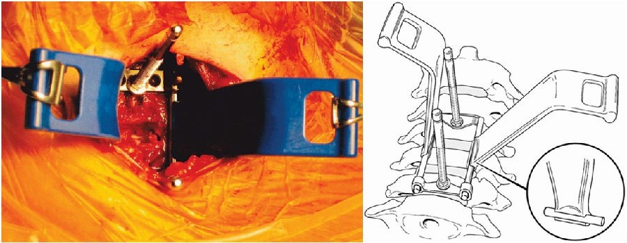 1498034227846510.jpg 4.jpg