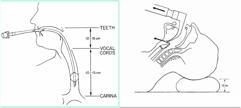 1498034247600229.png 5.png