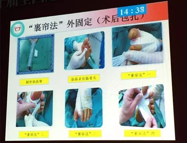 1505978396564969.jpg 2.jpg