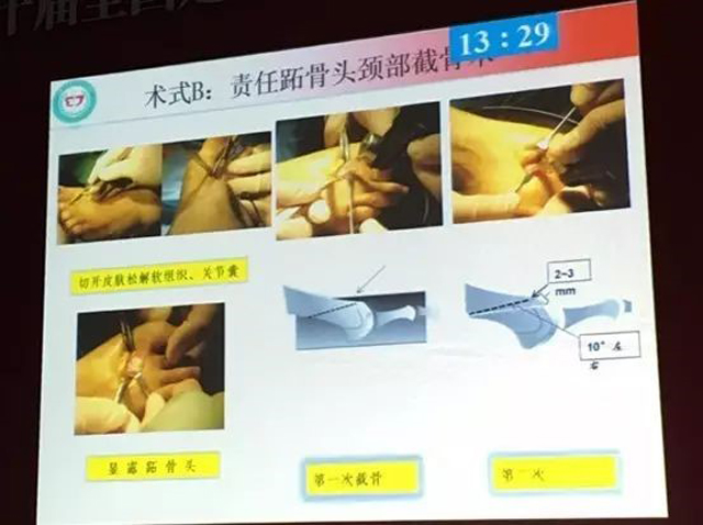 1505978423597025.jpg 3.jpg