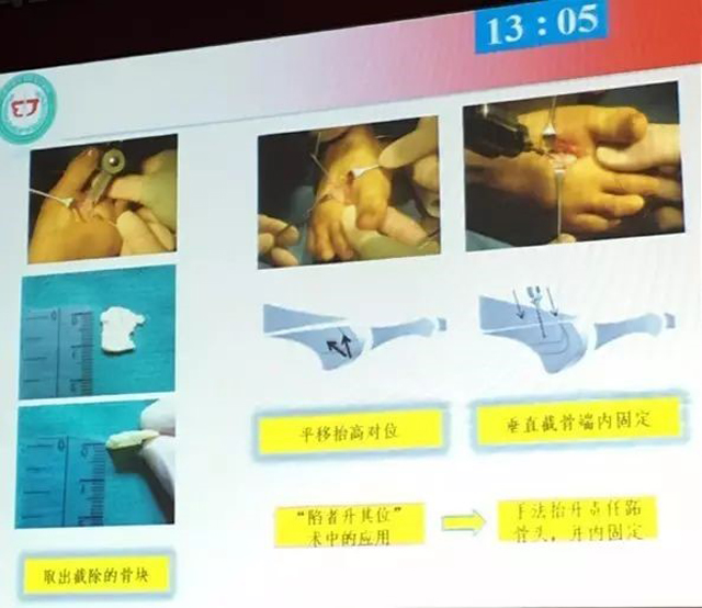 1505978456471303.jpg 4.jpg