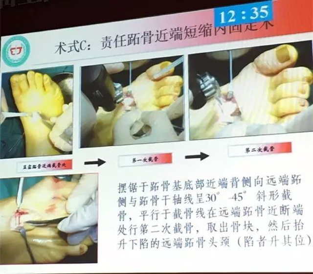 1505978536529038.jpg 6.jpg