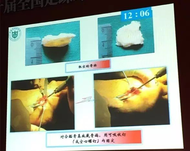 1505978575539702.jpg 7.jpg