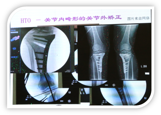 1506578261929898.png image016.png