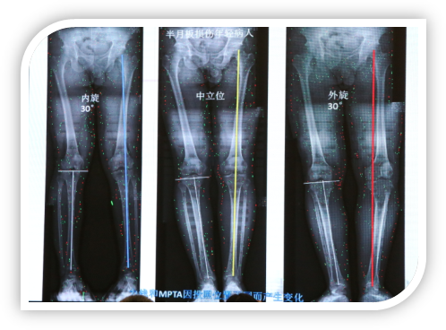 1506578305586655.png image013.png