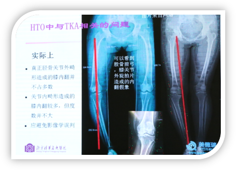 1506578395444026.png image010.png