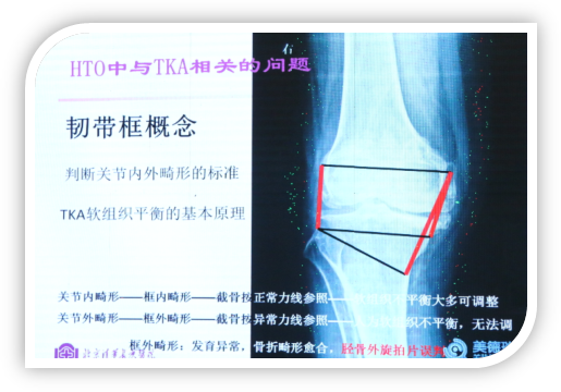 1506578407405413.png image009.png