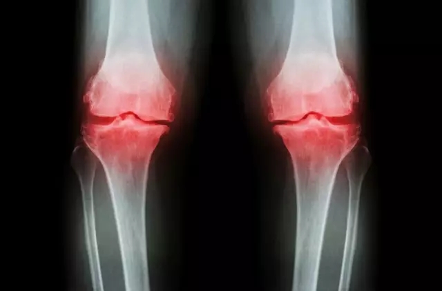 1524448071785437.jpg 640.webp (54).jpg