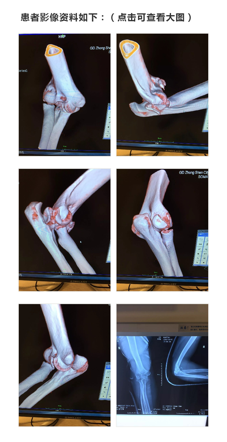 1555406777677758.png 2.png