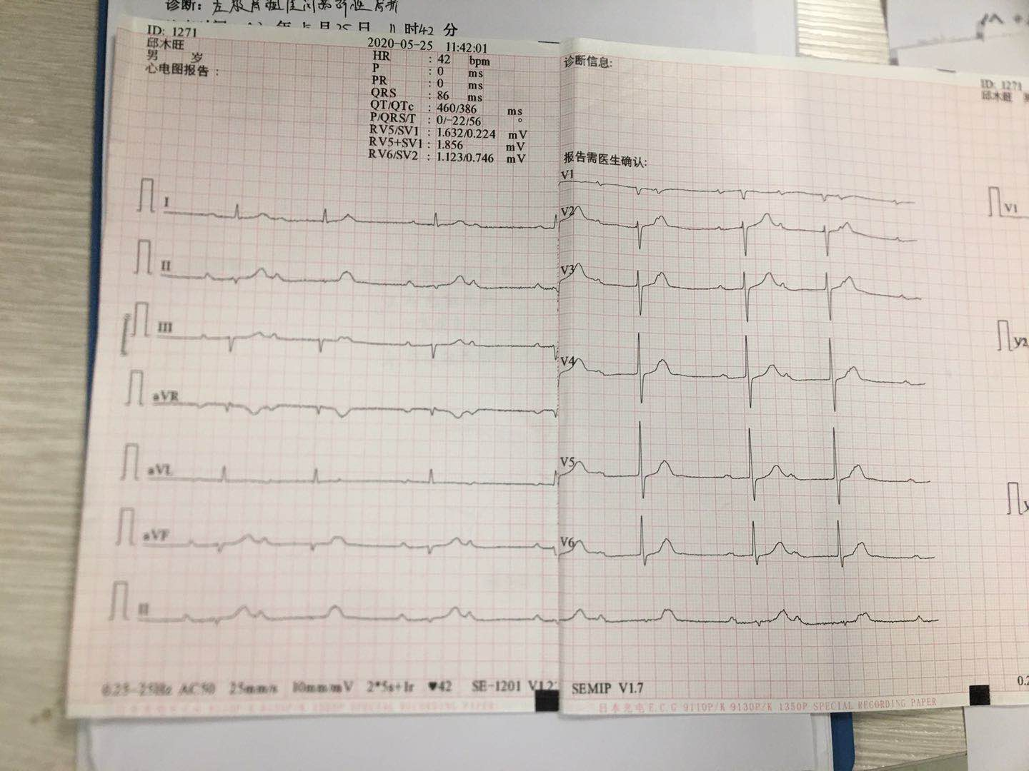 1594963483814865.png 1594963483814865.png