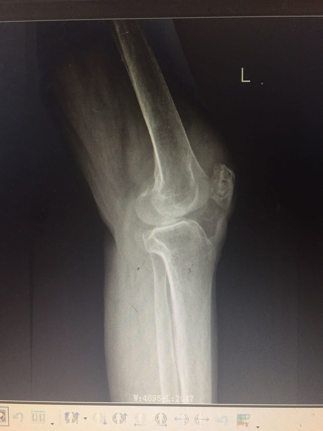 1598259540119500.png 1598259540119500.png