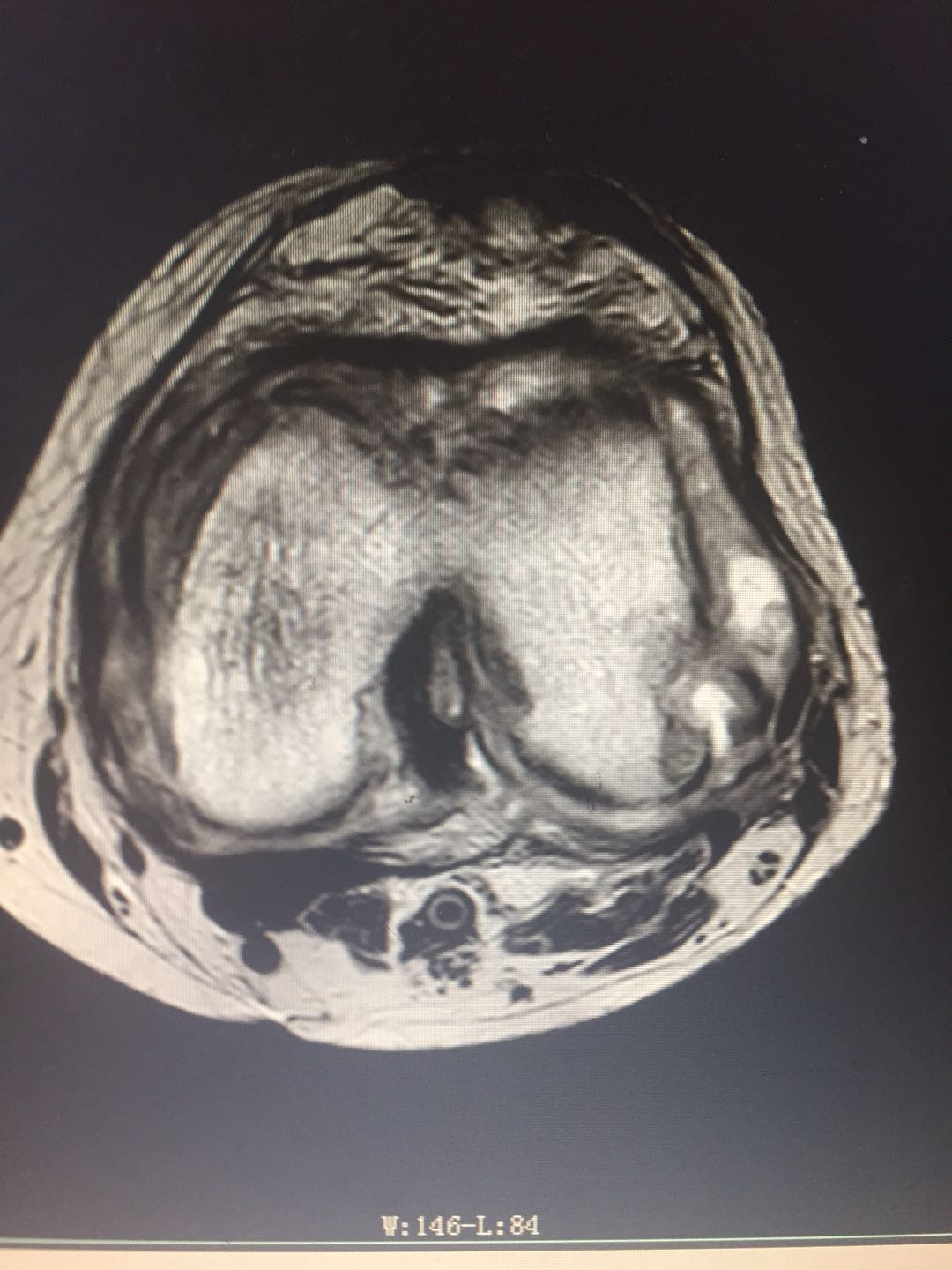 1598259540164706.png 1598259540164706.png