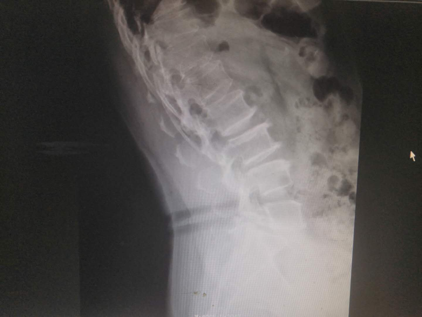 1598323993979706.png 1598323993979706.png