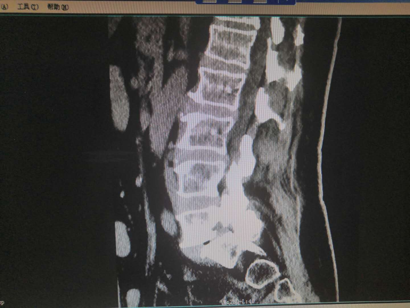 1598323994249028.png 1598323994249028.png