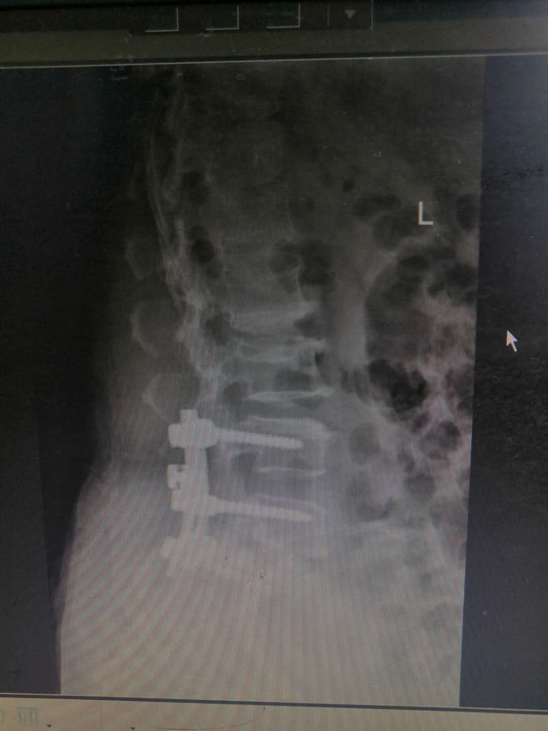 1598324087611785.png 1598324087611785.png