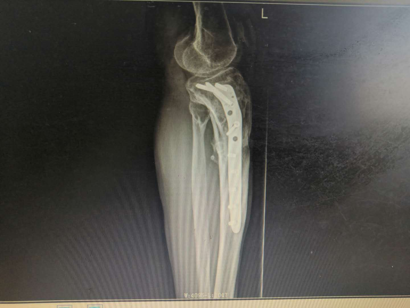 1598324150170814.png 1598324150170814.png