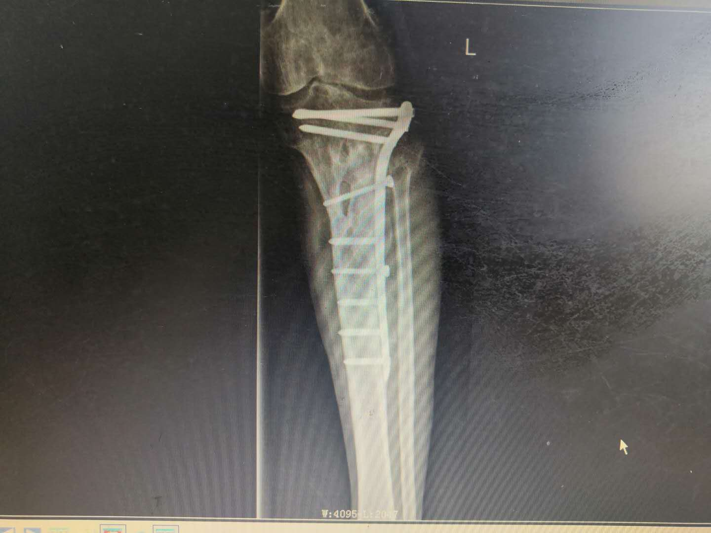 1598324150719209.png 1598324150719209.png