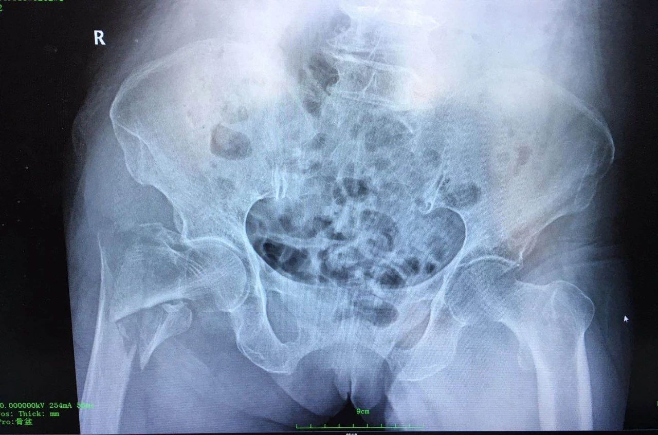 1600915604156236.jpg 1600915604156236.jpg