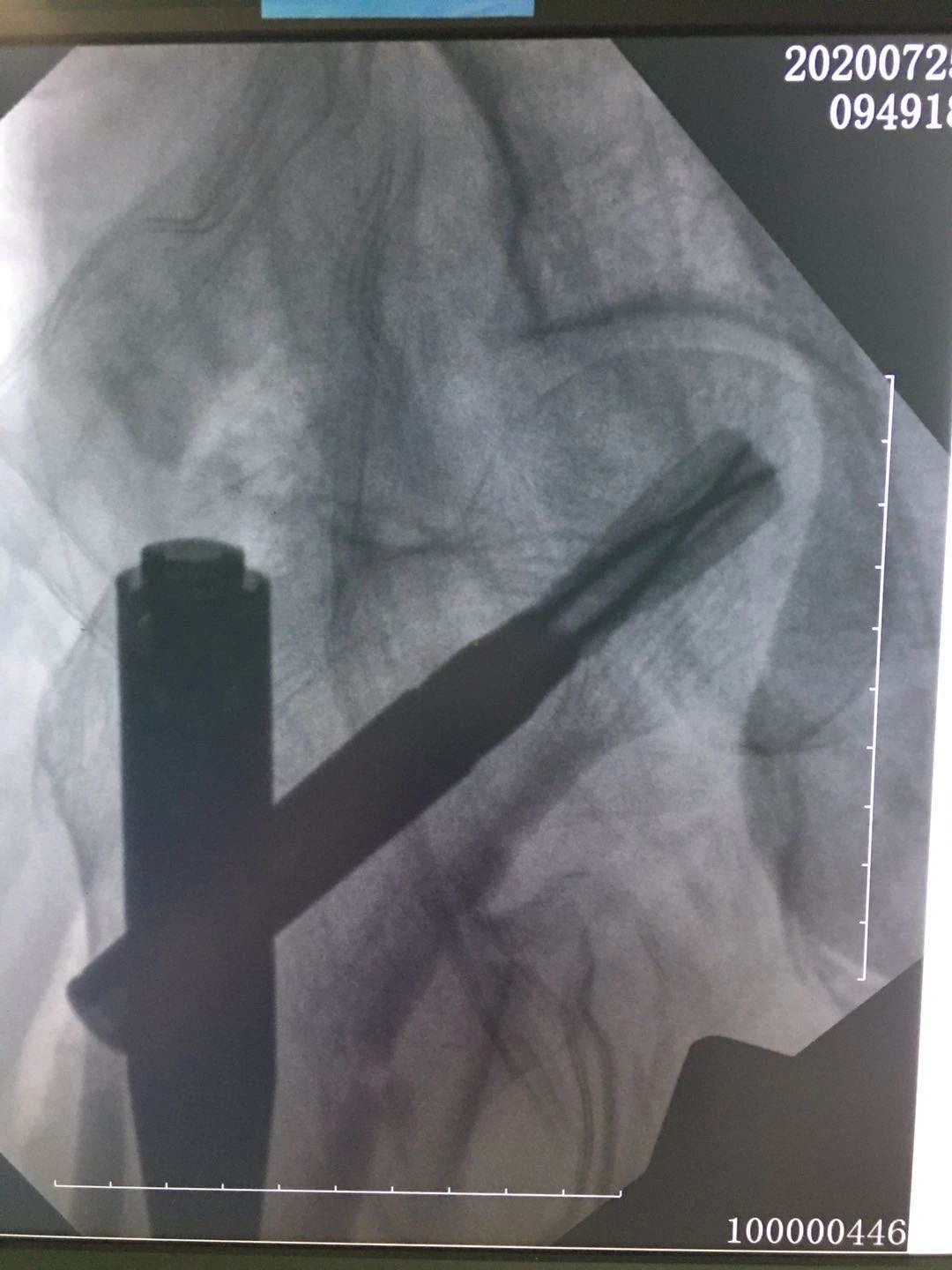 1600915673717922.jpg 1600915673717922.jpg