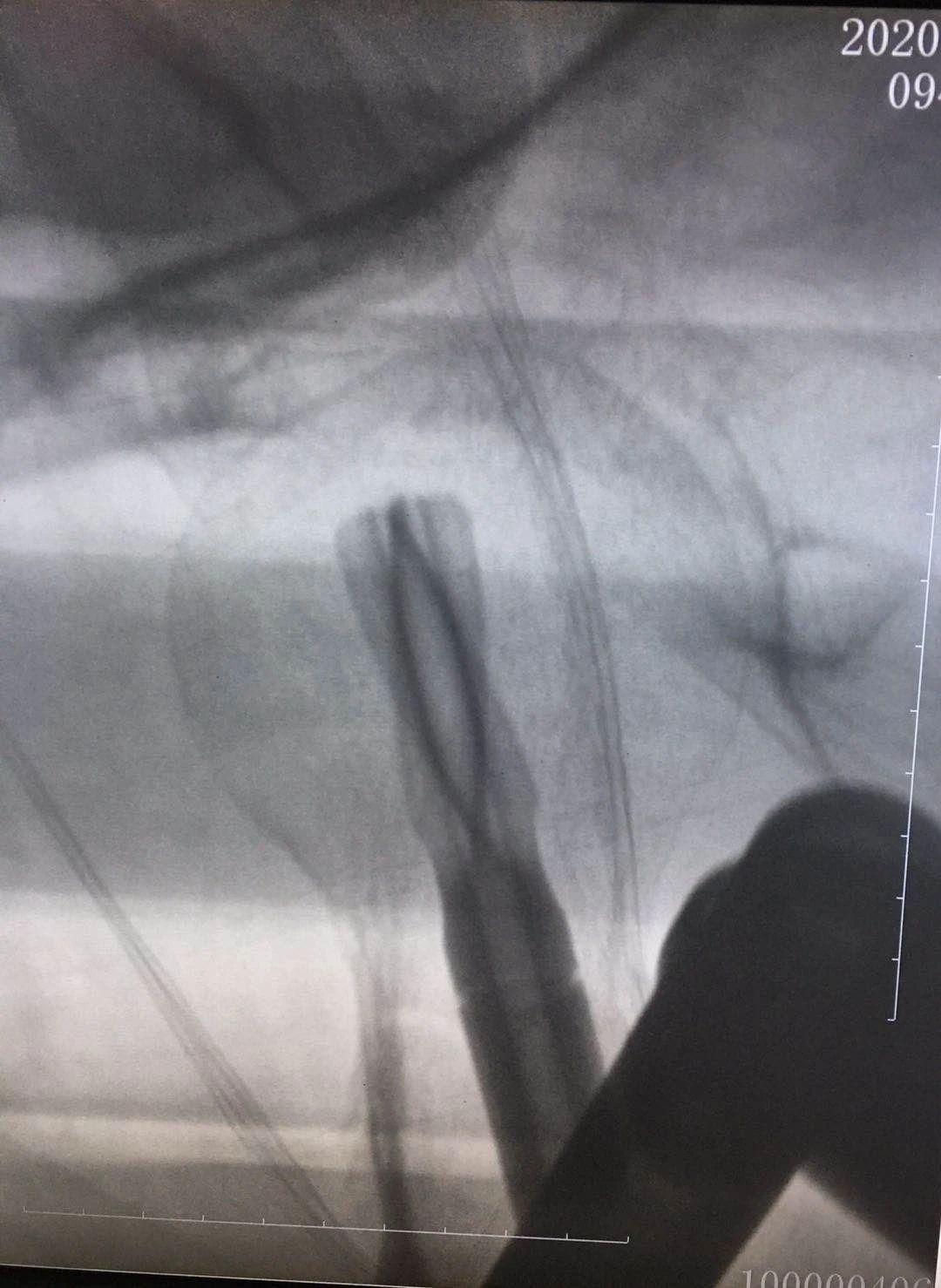 1600915761795958.jpg 1600915761795958.jpg