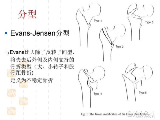 1600915872932792.jpg 1600915872932792.jpg