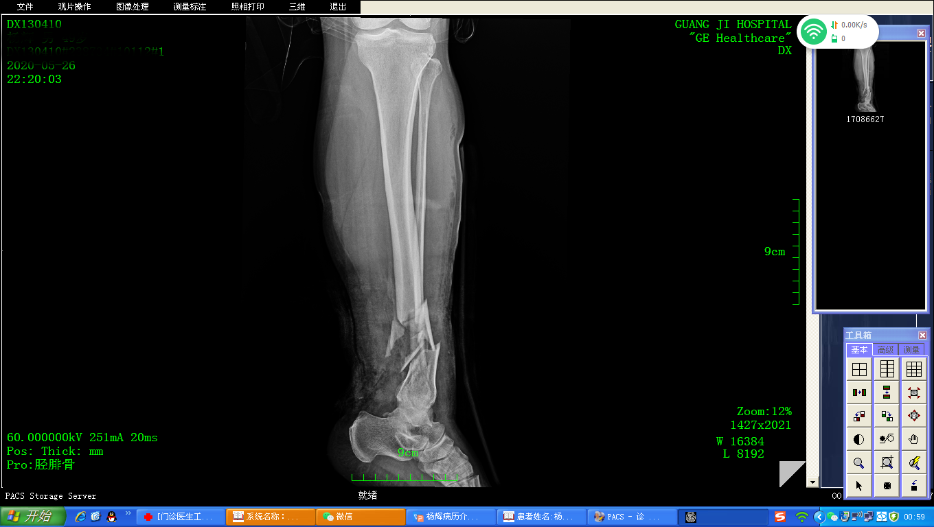 1605165665212467.png 1594963235404917.png