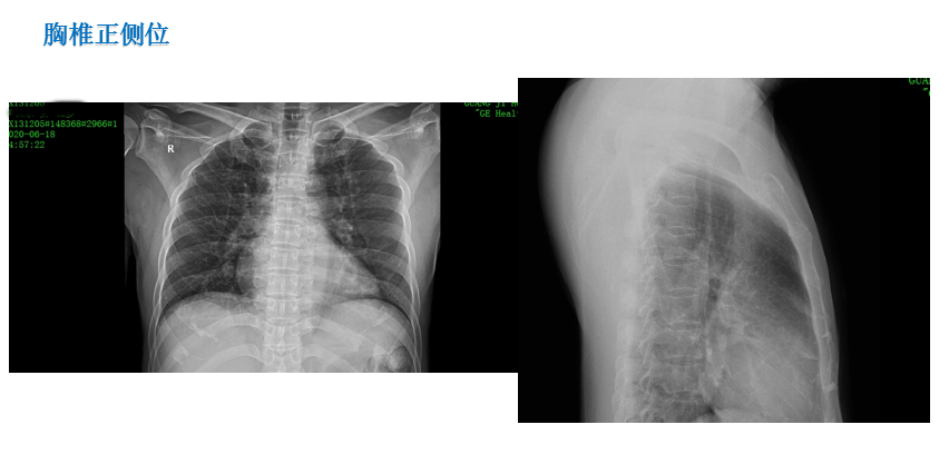 1605165708713901.png 1594962913985108.png