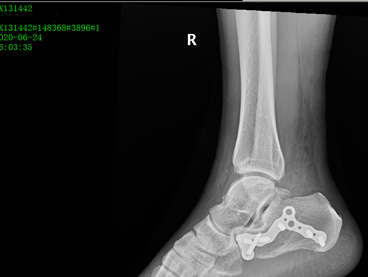 1605165797319473.png 1594962965733859.png