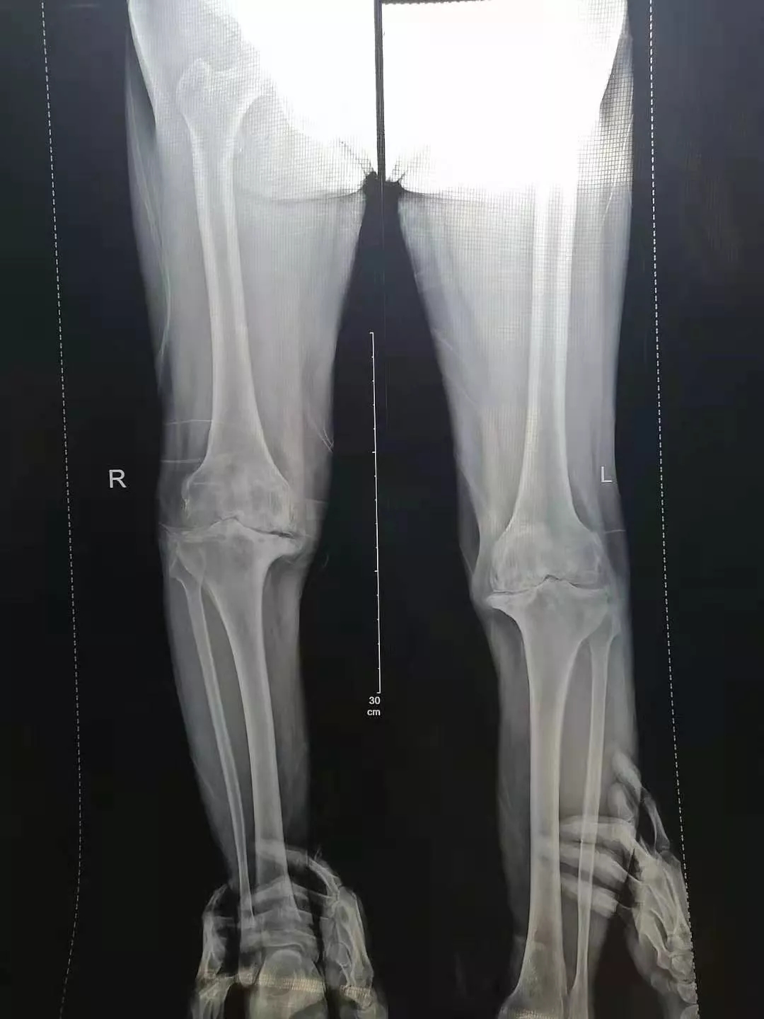 1613718148878887.jpg 1613718148878887.jpg