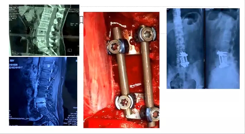 1617763862125546.jpg 1617763862125546.jpg