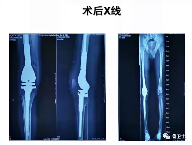 1619155964398011.jpg 1619155964398011.jpg