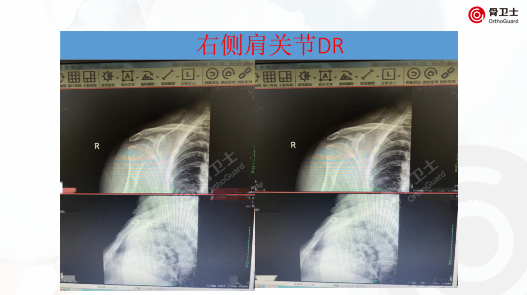 1653889709221912.png f74a62bf62dec80d24f302a5ae0e9060_640_wx_fmt=png&wxfrom=5&wx_lazy=1&wx_co=1.png