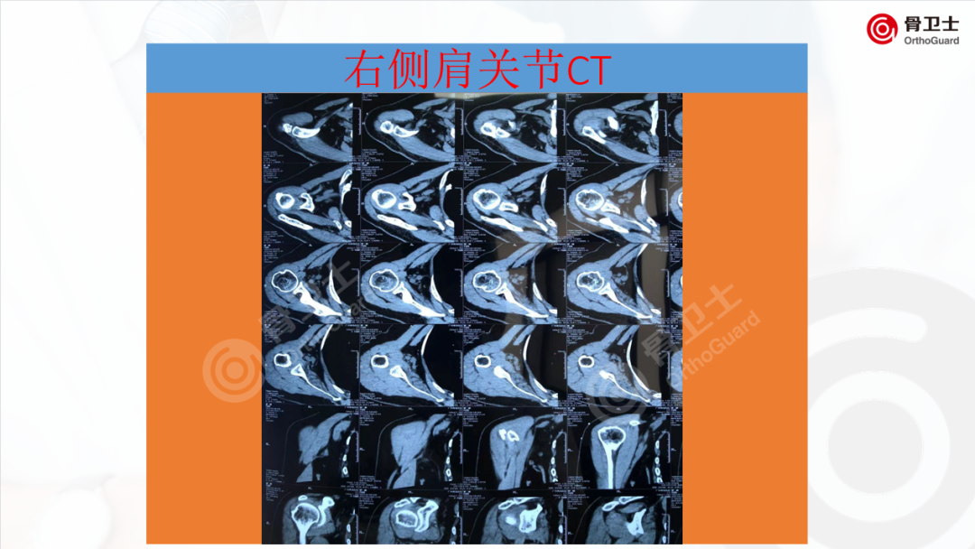 1653889727864884.png 97ff445fce56e1431bd315bc43d26eff_640_wx_fmt=png&wxfrom=5&wx_lazy=1&wx_co=1.png