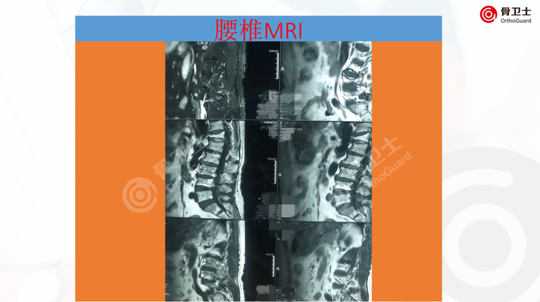 1653889740239210.png 51c73ee117cdf3e8f586ee7ea5fa3ed5_640_wx_fmt=png&wxfrom=5&wx_lazy=1&wx_co=1.png