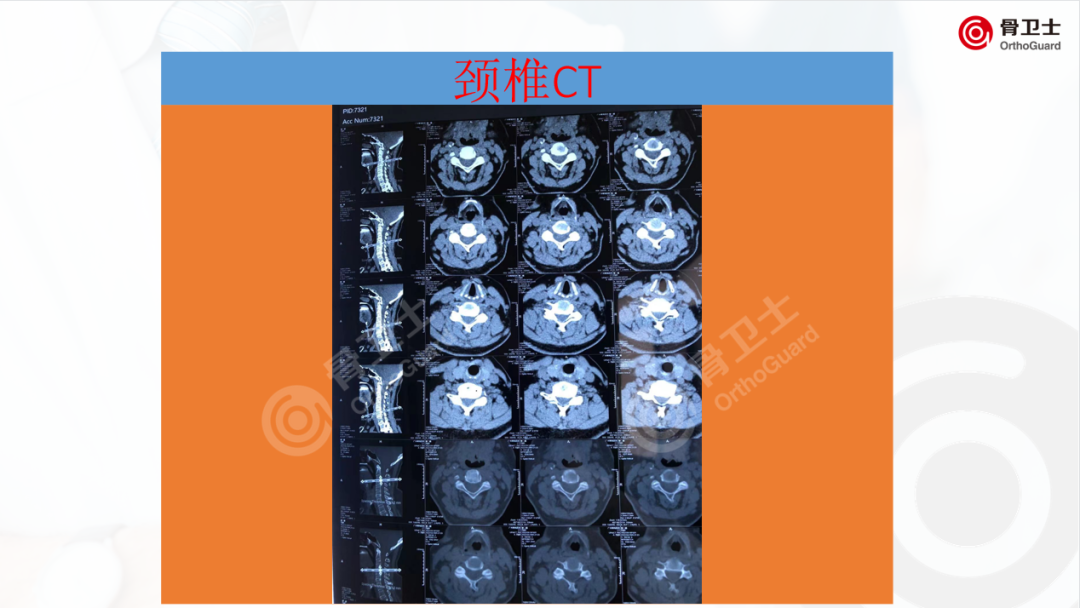 1653889823371511.png d40fd1f44487335066a4253e7223adb9_640_wx_fmt=png&wxfrom=5&wx_lazy=1&wx_co=1.png