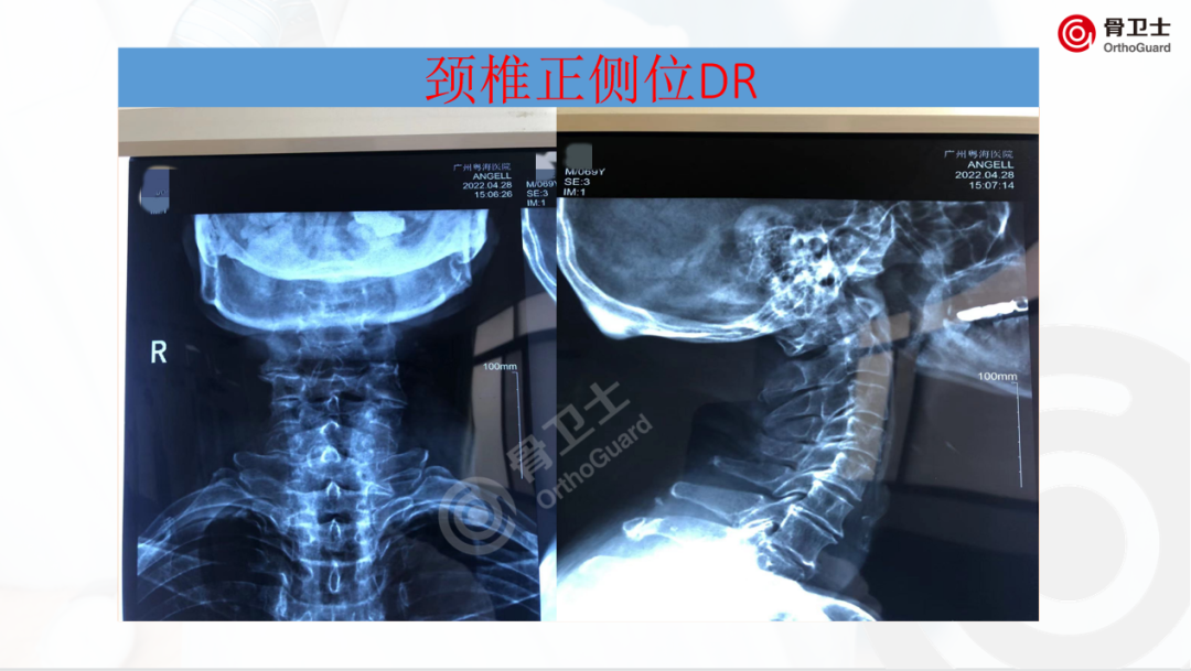 1653889861553380.png 8c00a9c64329f1c548ef6ec626b8cb79_640_wx_fmt=png&wxfrom=5&wx_lazy=1&wx_co=1.png