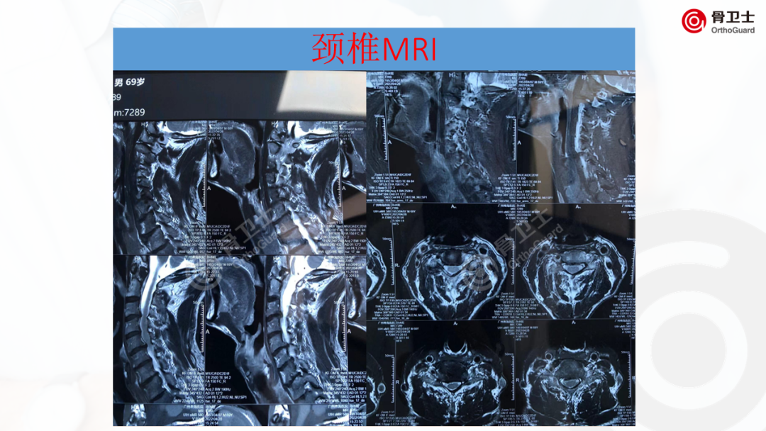 1653889873662825.png 431c4734cc1c0941615169d437f46bf4_640_wx_fmt=png&wxfrom=5&wx_lazy=1&wx_co=1.png