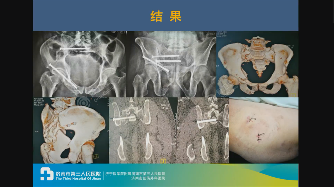 1694572478387901.png 1694572478387901.png